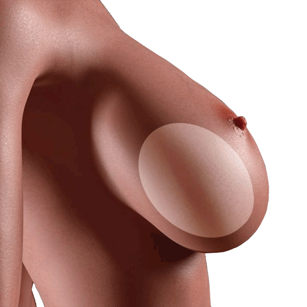 Gel Breast